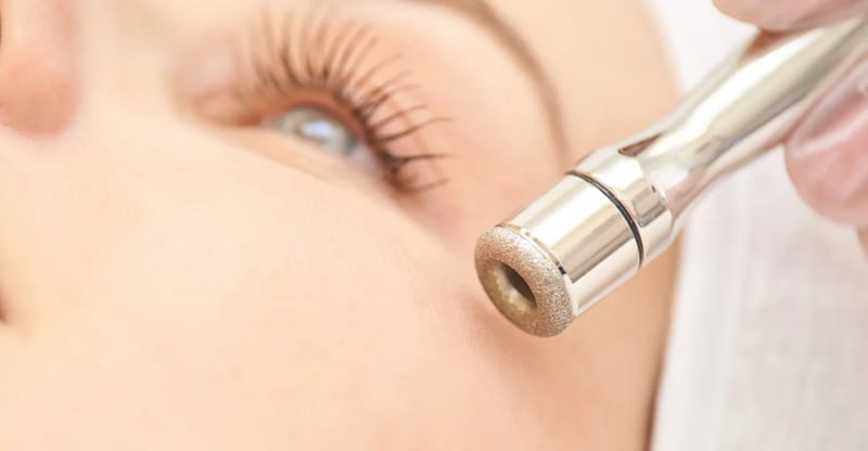 Microdermabrasion Facial Special