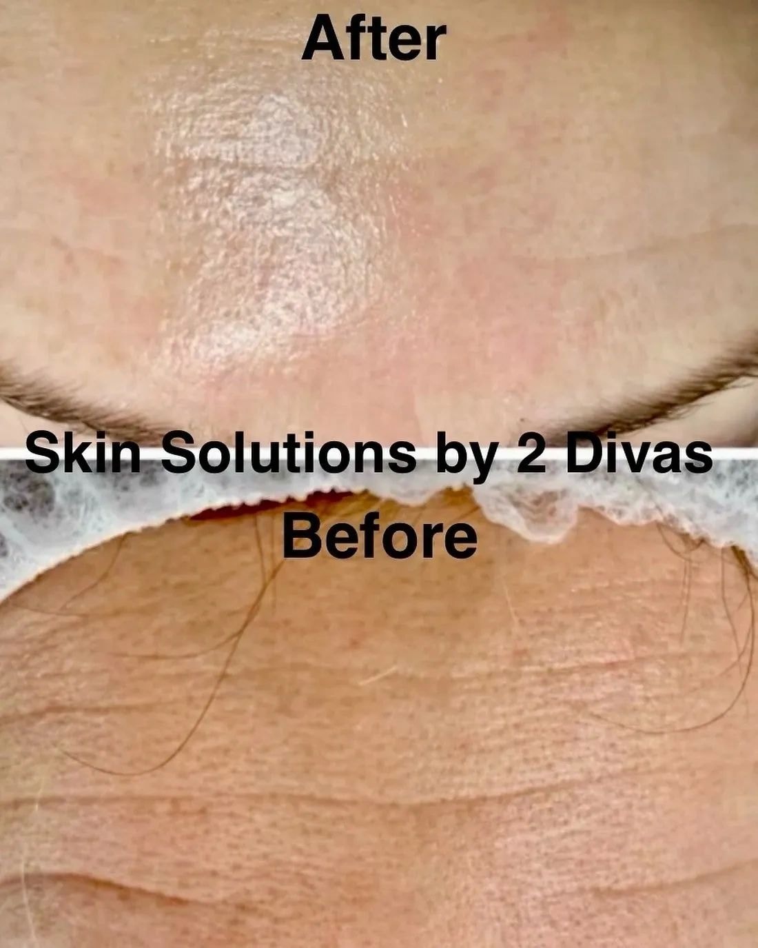 Glow result